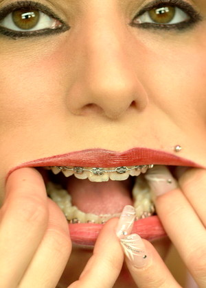 Beautyandbraces Model