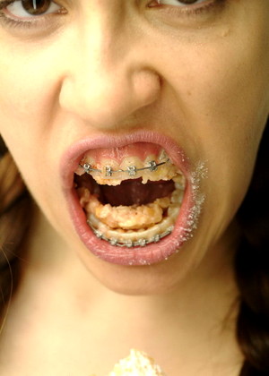 Beautyandbraces Model